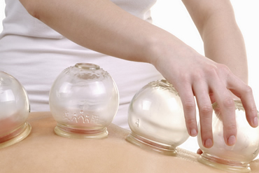 Cupping therapy